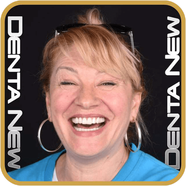 dentanew-hasta-after-3