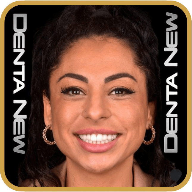 dentanew-hasta-after-4