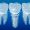 yapay-zeka-dental-implant_1200x800