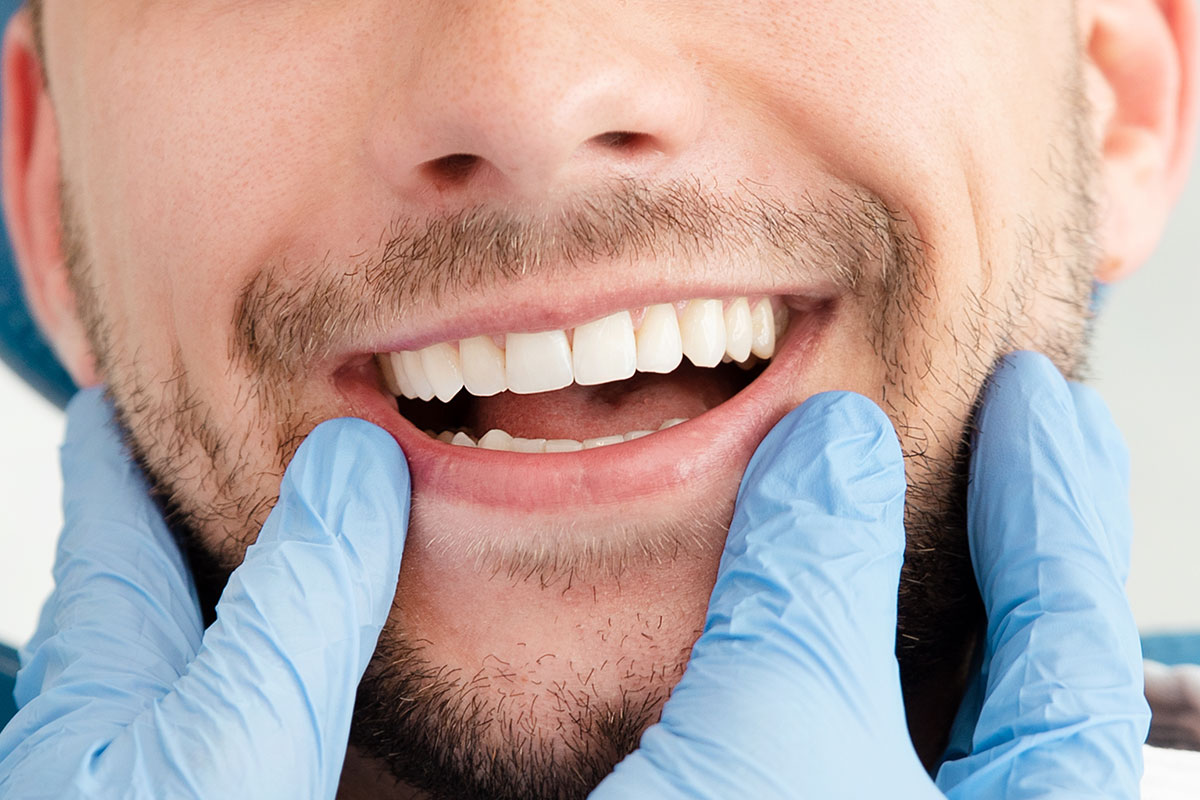 Gülüş Estetiği Kapsamlı Rehber 2025